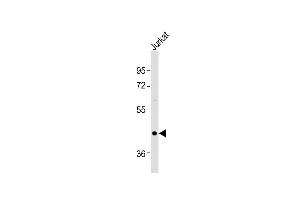 Anti-OXTR Antibody (C-term)at 1:1000 dilution + Jurkat whole cell lysates Lysates/proteins at 20 μg per lane. (Oxytocin Receptor Antikörper  (C-Term))