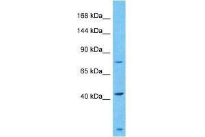 Host:  Rabbit  Target Name:  ZSC29  Sample Type:  Fetal Liver lysates  Antibody Dilution:  1. (ZSCAN29 Antikörper  (C-Term))