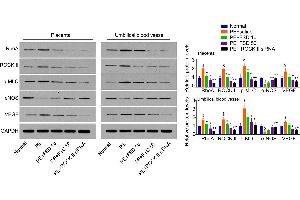 Fasudil regulates the expression of RhoA, ROCK, p-MLC, eNOS and VEGF in placenta and umbilical vessel from PE miceWestern blot analysis for RhoA, ROCK, p-MLC, eNOS and VEGF in mice placenta and umbilical vessel, and quantification. (VEGFA Antikörper  (AA 81-132))