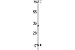 Western blot analysis of Destrin  Antibody  in MCF-7 cell line lysates (35ug/lane). (Destrin Antikörper  (Middle Region))