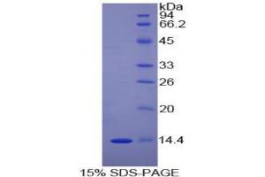 SDS-PAGE analysis of Human DDT Protein. (DDT Protein)