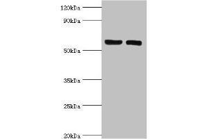 Western blot All lanes: ADP-ribosylation factor-binding protein GGA2 antibody at 10 μg/mL Lane 1: Rat brain tissue Lane 2: Mouse liver tissue Secondary Goat polyclonal to rabbit IgG at 1/10000 dilution Predicted band size: 67 kDa Observed band size: 67 kDa (GGA2 Antikörper  (AA 1-300))