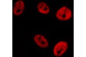 ABIN6276281 staining  Hela cells by IF/ICC.
