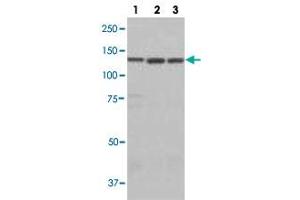 Western blot analysis of lane 1: A549 cell lysate, lane 2: HEK293 cell lysate and lane 3: HeLa cell lysate using LARS polyclonal antibody . (LARS Antikörper)
