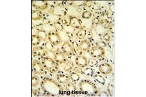H6PD Antibody (C-term) (ABIN651229 and ABIN2840142) IHC analysis in formalin fixed and paraffin embedded lung tissue followed by peroxidase conjugation of the secondary antibody and DAB staining. (Glucose-6-Phosphate Dehydrogenase Antikörper  (C-Term))
