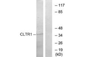 Western blot analysis of extracts from COS7 cells, using CLTR1 Antibody. (CysLTR1 Antikörper  (AA 131-180))