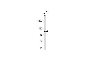 Anti-TCIRG1 Antibody (C-Term) at 1:2000 dilution + EL4 whole cell lysate Lysates/proteins at 20 μg per lane. (TCIRG1 Antikörper  (AA 668-702))