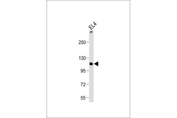 TCIRG1 antibody  (AA 668-702)