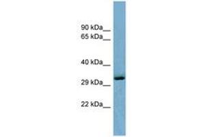 Image no. 1 for anti-OTU Domain Containing 6B (OTUD6B) (C-Term) antibody (ABIN6741941) (OTUD6B Antikörper  (C-Term))