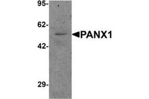 Western blot analysis of PANX1 in human ovary tissue lysate with PANX1 Antibody  at 1 μg/ml.