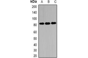 Western blot analysis of EIF4B expression in MCF7 (A), 22RV1 (B), Hela (C) whole cell lysates. (EIF4B Antikörper)