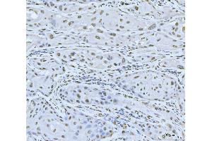 IHC analysis of MRE11 using anti-MRE11 antibody (ABIN7600025). (Mre11 Antikörper  (AA 14-481))