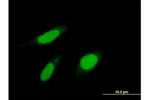 Immunofluorescence of purified MaxPab antibody to KPNA1 on HeLa cell.