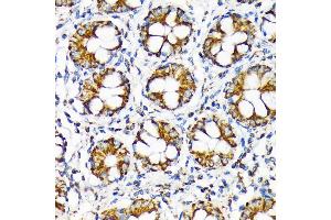 Immunohistochemistry of paraffin-embedded human colon using TOMM22 Rabbit mAb (ABIN7270930) at dilution of 1:100 (40x lens). (TOMM22 Antikörper)