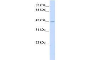 WB Suggested Anti-SRD5A3 Antibody Titration:  0. (SRD5A3 Antikörper  (N-Term))