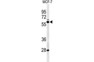 Western Blotting (WB) image for anti-Nuclear Receptor Subfamily 1, Group H, Member 3 (NR1H3) antibody (ABIN5024918) (NR1H3 Antikörper)