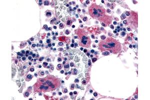 Immunohistochemistry (IHC) image for anti-Purinergic Receptor P2Y, G-Protein Coupled, 12 (P2RY12) (Extracellular Domain) antibody (ABIN1049208)