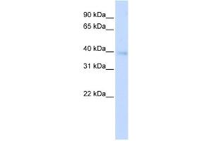 WB Suggested Anti-HOXA11 Antibody Titration: 0. (Homeobox A11 Antikörper  (Middle Region))