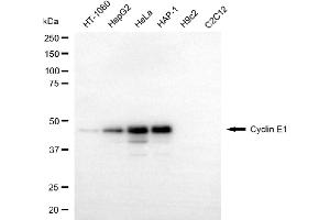 Western blotting analysis using cyclin E1 antibody (ABIN7798198). (Rekombinanter Cyclin E1 Antikörper)