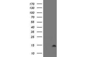 Image no. 1 for anti-Cystatin SA (CST2) antibody (ABIN1497757) (CST2 Antikörper)