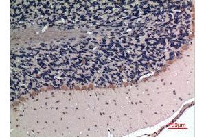 Immunohistochemistry (IHC) image for anti-Apelin (APLN) (C-Term) antibody (ABIN3187705)