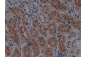 IHC-P analysis of Rat Kidney Tissue, with DAB staining. (CUBN Antikörper  (AA 3511-3623))