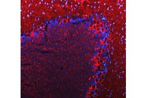 IF analysis of SLC6A1 using anti-SLC6A1 antibody (ABIN5518957). (SLC6A1 Antikörper  (N-Term))