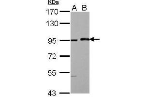 WB Image Sample (30 ug of whole cell lysate) A: HeLa B: HeLa nucleus 7.