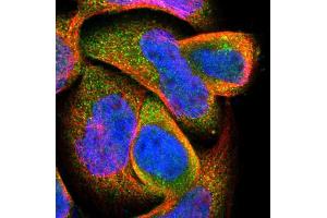 Immunofluorescent staining of human cell line A-431 with DPP8 polyclonal antibody  shows positivity in cytoplasm. (DPP8 Antikörper  (AA 17-135))