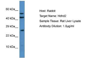 Host: Rabbit Target Name: Hdhd2 Sample Type: Rat Liver lysates Antibody Dilution: 1. (HDHD2 Antikörper  (N-Term))