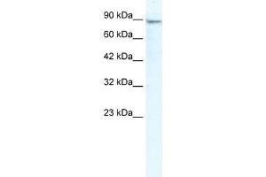 WB Suggested Anti-MCM4 Antibody Titration:  2. (MCM4 Antikörper  (N-Term))