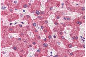 Immunohistochemistry (Formalin-fixed Paraffin-embedded Sections) (IHC (fp)) image for anti-NADH Dehydrogenase (Ubiquinone) 1 alpha Subcomplex, Assembly Factor 2 (NDUFAF2) (C-Term) antibody (ABIN605128)