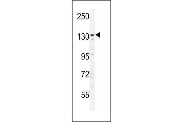 ZNF536 Antikörper  (N-Term)
