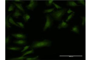 Immunofluorescence of monoclonal antibody to BOLL on HeLa cell. (BOLL Antikörper  (AA 185-283))