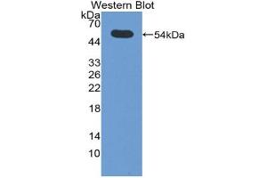 Western blot analysis of the recombinant protein. (SIAE Antikörper  (AA 22-244))