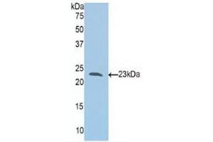 Western blot analysis of recombinant Human Slit1. (SLIT1 Antikörper  (AA 647-835))