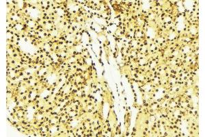 ABIN6274256 at 1/100 staining Mouse liver tissue by IHC-P. (FRK Antikörper  (Internal Region))
