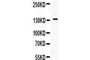 Western Blotting (WB) image for anti-Selectin P (Granule Membrane Protein 140kDa, Antigen CD62) (SELP) (AA 49-66), (N-Term) antibody (ABIN3044277)