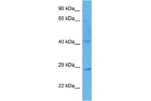 Host:  Rabbit  Target Name:  C21ORF58  Sample Tissue:  Human PANC1 Whole Cell lysates  Antibody Dilution:  1ug/ml (C21orf58 Antikörper  (N-Term))