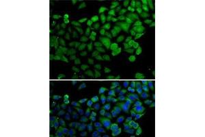 Immunofluorescence analysis of A-549 cells using SYNCRIP Polyclonal Antibody (SYNCRIP Antikörper)