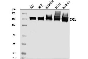 Western blot analysis of CPS1 using anti-CPS1 antibody (ABIN7599871). (CPS1 Antikörper  (AA 124-379))
