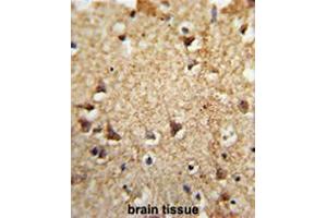 Immunohistochemistry (Paraffin-embedded Sections) (IHC (p)) image for anti-Eukaryotic Translation Initiation Factor 2A, 65kDa (EIF2A) (AA 444-473), (Middle Region) antibody (ABIN952042)