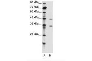Image no. 1 for anti-Chromobox Homolog 8 (CBX8) (C-Term) antibody (ABIN202404) (CBX8 Antikörper  (C-Term))