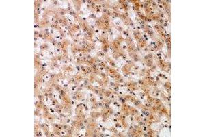 Immunohistochemical analysis of SOCS2 staining in human liver formalin fixed paraffin embedded tissue section. (SOCS2 Antikörper)