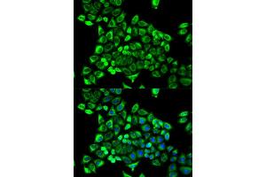 Immunofluorescence analysis of MCF-7 cells using CDA antibody (ABIN5971047). (CDA Antikörper)