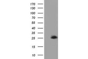 HEK293T cells were transfected with the pCMV6-ENTRY control (Left lane) or pCMV6-ENTRY AK3 (Right lane) cDNA for 48 hrs and lysed. (Adenylate Kinase 3 Antikörper)