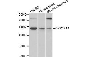 Western blot analysis of extracts of various cell lines, using CYP19A1 antibody (ABIN5971188) at 1/1000 dilution. (Aromatase Antikörper)