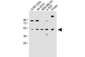 All lanes : Anti-EDIL3 Antibody (Center) at 1:1000 dilution Lane 1: CCRF-CEM whole cell lysate Lane 2: SH-SY5Y whole cell lysate Lane 3: MDA-MB-231 whole cell lysate Lane 4: U-2OS whole cell lysate Lane 5: Rat brain whole lysate Lysates/proteins at 20 μg per lane.