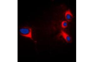 Immunofluorescent analysis of cTnI staining in HepG2 cells. (TNNI3 Antikörper  (N-Term))