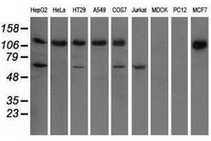 Image no. 2 for anti-Insulin-Like Growth Factor 2 mRNA Binding Protein 2 (IGF2BP2) antibody (ABIN1498824)